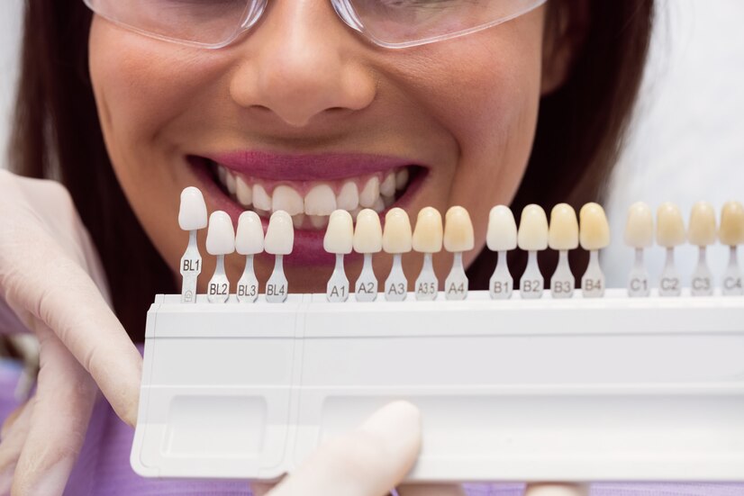 dentist-examining-female-patient-with-teeth-shades_107420-65410