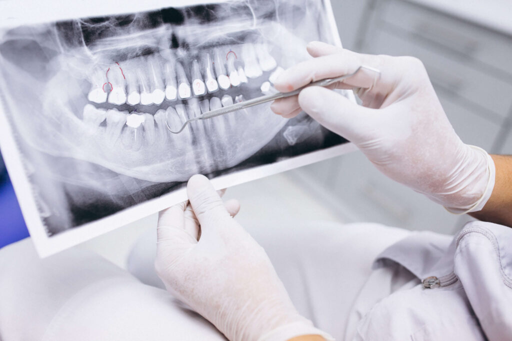 x-ray-teeth-scaled